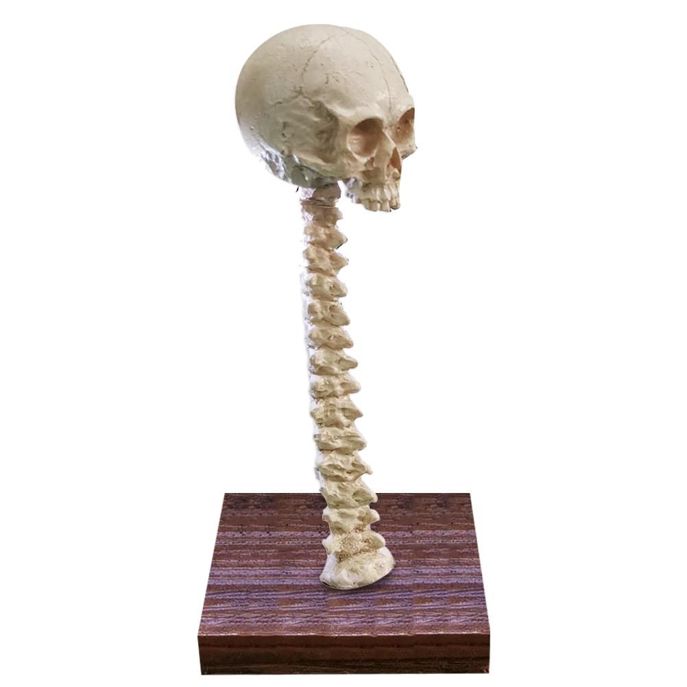 Skeleton